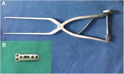 The use of a novel reduction plate in transoral anterior C1-ring <mark class="highlighted">osteosynthesis</mark> for unstable atlas fractures